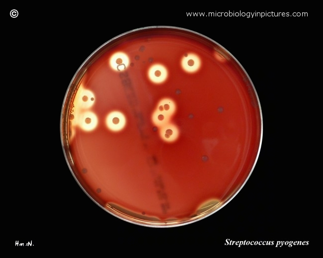 streptococcus pyogenes and enterococcus faecalis colonies